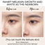 Alike Kojic Acid Brightening Cream - 25 gm image