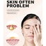 Bioaqua Anti-Acne Serum Removal of Acne 30 ml image