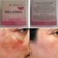 Bioaqua P Vita Melasma Mesta Whitening Cream -10 gm (Thailand) image