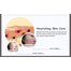 Bioaqua Removal of Acne Rejuvenation Essence 100 gm -327153742 image