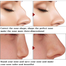 Bonixiya Nose Massage Essential Oil 30ml image