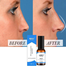 Bonixiya Nose Massage Essential Oil 30ml image