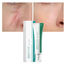 Breylee Acne Scar Removal Cream - 30gm image
