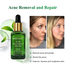 Breylee Acne Treatment Set 4 Pcs (Facial Cleanser, Acne Gel, Serum ,Cream) image