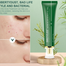 Breylee Acne Treatment Set 4 Pcs (Facial Cleanser, Acne Gel, Serum ,Cream) image