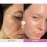 Cosrx The Niacinamide 15 Serum 20 ml image