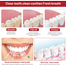 Croent SP-10 Probiotic Bright And Whitening Toothpaste-120gm image