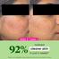 DOT and KEY Cica plus Niacinamide Oil Free Moisturizer – 15ml image