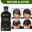 Dexe Hair Shampoo Anti hair Loss Chinese Herbal Hair Growth For Men image