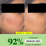Dot and Key CICA Plus Niacinamide Oil Free Moisturizer 60ml image