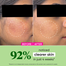 Dot and Key Cica Plus Niacinamide Oil Free Moisturizer 50 gm -479148516 image
