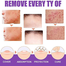 EELHOE Skin Tag Remover 10ml image