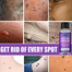 EELHOE Skin Tag Remover 10ml image