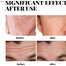 Eelhoe Collagen Hydrolyzed 5 Percent 30gm image