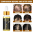 Eelhoe Hair Essential Oil for Scalp and Hair Care - 20 gm image