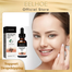 Eelhoe Melanin Correcting Serum Fade Dark Spots Anti Freckle Melasma Remover Lightening Pigment Blemish Vitamin C Face Essence-30ml image