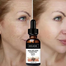 Eelhoe Melanin Correcting Serum Fade Dark Spots Anti Freckle Melasma Remover Lightening Pigment Blemish Vitamin C Face Essence-30ml image