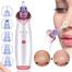 Electric Blackhead Acne Oil Remover image