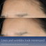 Estee Lauder Advanced Night Repair Serum Synchronized Multi-Recovery Complex 50ml image