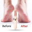 Flawless Pedi Rechargeable Pedicure Tool -1Pcs image