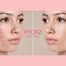 Gongskin B5 PPORZ B5 Spot Cream 30 ml | Korea image