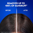 Head and Shoulders Anti Hairfall Anti-Dandruff Shampoo 400ml image