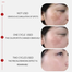 Houmal Whitening And Freckle Removing Essence Serum 50ml image