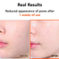 Isntree Hyper Niacinamide 20 Serum 20ml image