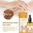 JAYSUING Private Label Therapy Drops Serum Knee Elbow Finger Joint Brightening Darkening Treatment Skin Care Serum-10ml image