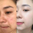 Japan Anti Freckle Super Whitening Cream 25g image