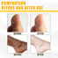 Jaysuing Peeling Oil for Dark Skin Super Strong Peeling Oil - 30 ml image