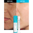 Jienasi Skin Stretch Marks Remover Gel - 10 ml image