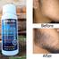 Kirkland Minoxidil 5percent for Hair and Beard Growth (One Month Supply) - 60ml (1 Pack) image