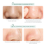 LAIKOU Tea Tree Mud Mask 5gm -5 Pcs image