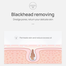 LANBENA Aloe Deep Cleansing Nose Strips Pack of 5 Pcs image