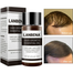 LANBENA Fast Powerful Hair Growth Essence Spray 2PCS Preventing Baldness Consolidating Anti Hair Loss Nourish Roots Hair Care image