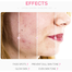 Laikou Japan Sakura Skin Care Set Sweet Kiss 4 Pcs image