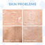 Laikou Milk Skincare Set 5 Pcs image