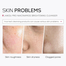 Laikou Pro Niacinamide Brightening Cleanser - 50 ml image