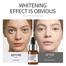 Laikou Pro Whitening Serum - 12ml image