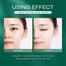 Laikou Tea Tree Anti-acne Treatment Cream - 20g image