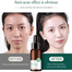 Laikou Australia Tea Tree Acne Treatment Brightening Moisturizing Oil Control Anti Acne SERUM-17ML image