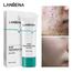 Lanbena Acne Treatment Gel - 20gm image