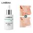 Lanbena Acne Treatment Serum - 15ml image