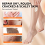 Lanbena Foot Repair Cream 100 gm image