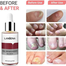 Lanbena Nail Repair Essence Serum - Fungal Treatment 3Pcs image