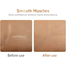 Lanbena Scar Removal Serum 20 ml image
