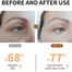 Lanbena Vitamin C Eye Patch Gel 30 Pairs image