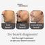 Man Matters BeardMax 5percent Minoxidil Beard Growth Serum - 30ml image