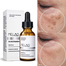 Melao 4 Percent Nicotinamide Serum Hydrating - 30ml image